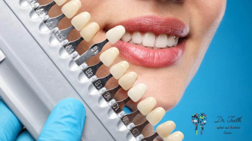 Cosmetic Teeth Restoration Options You Should Know